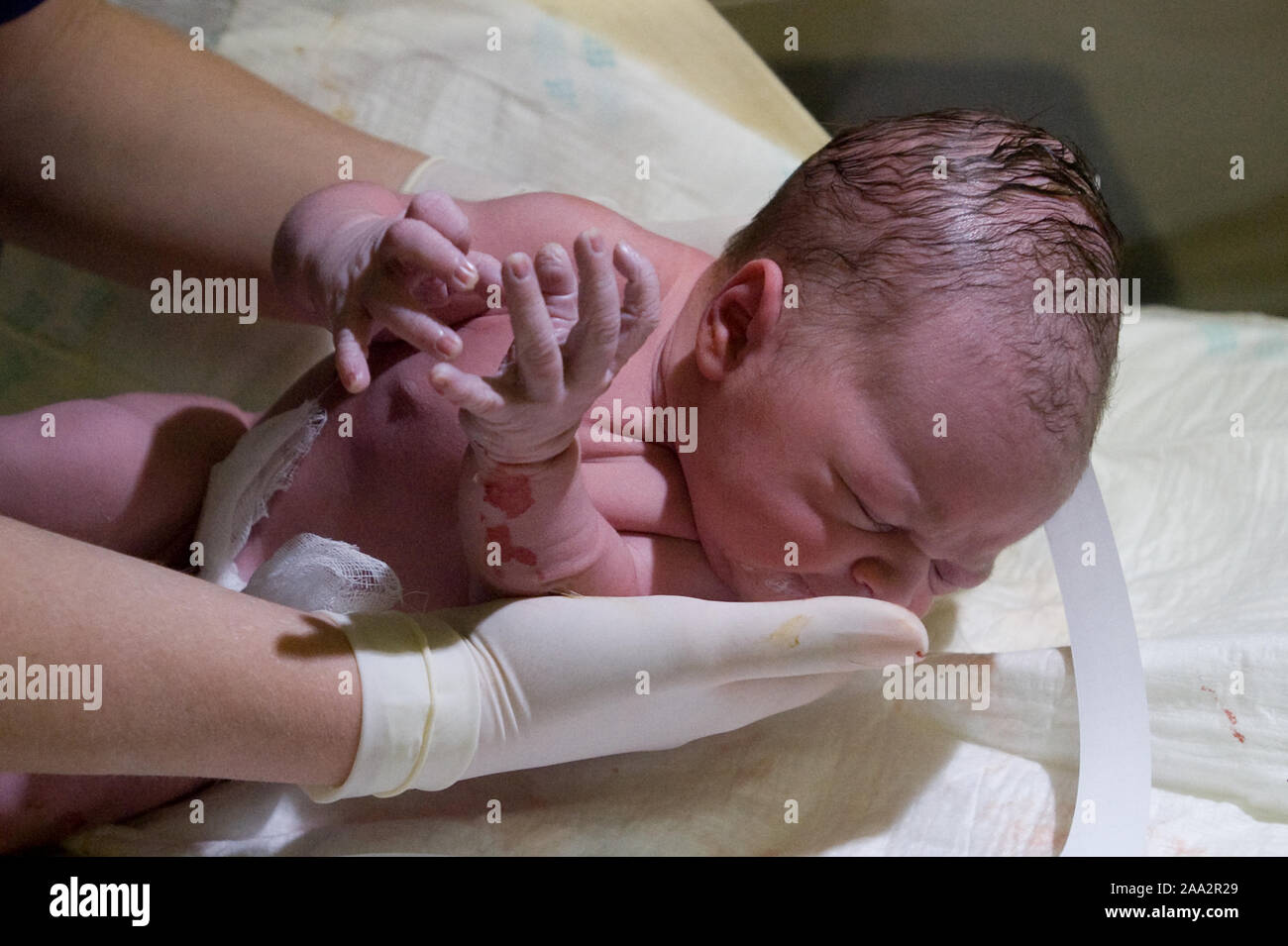 Baby girl momenti dopo il parto cesareo. ©Marcin Rozpedowski/Alamy Stock Photo Foto Stock