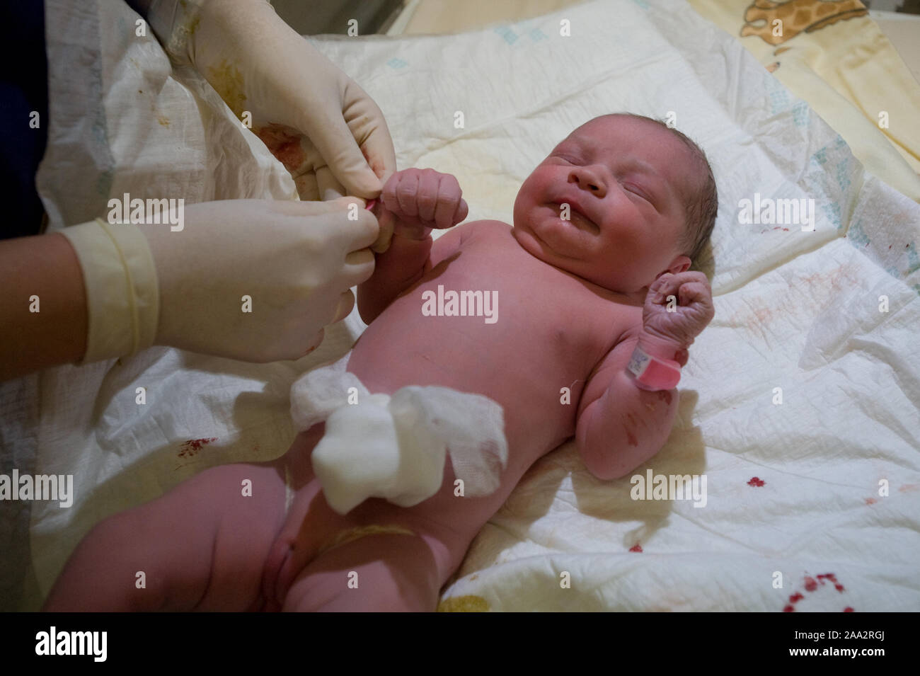 Baby girl momenti dopo il parto cesareo. ©Marcin Rozpedowski/Alamy Stock Photo Foto Stock