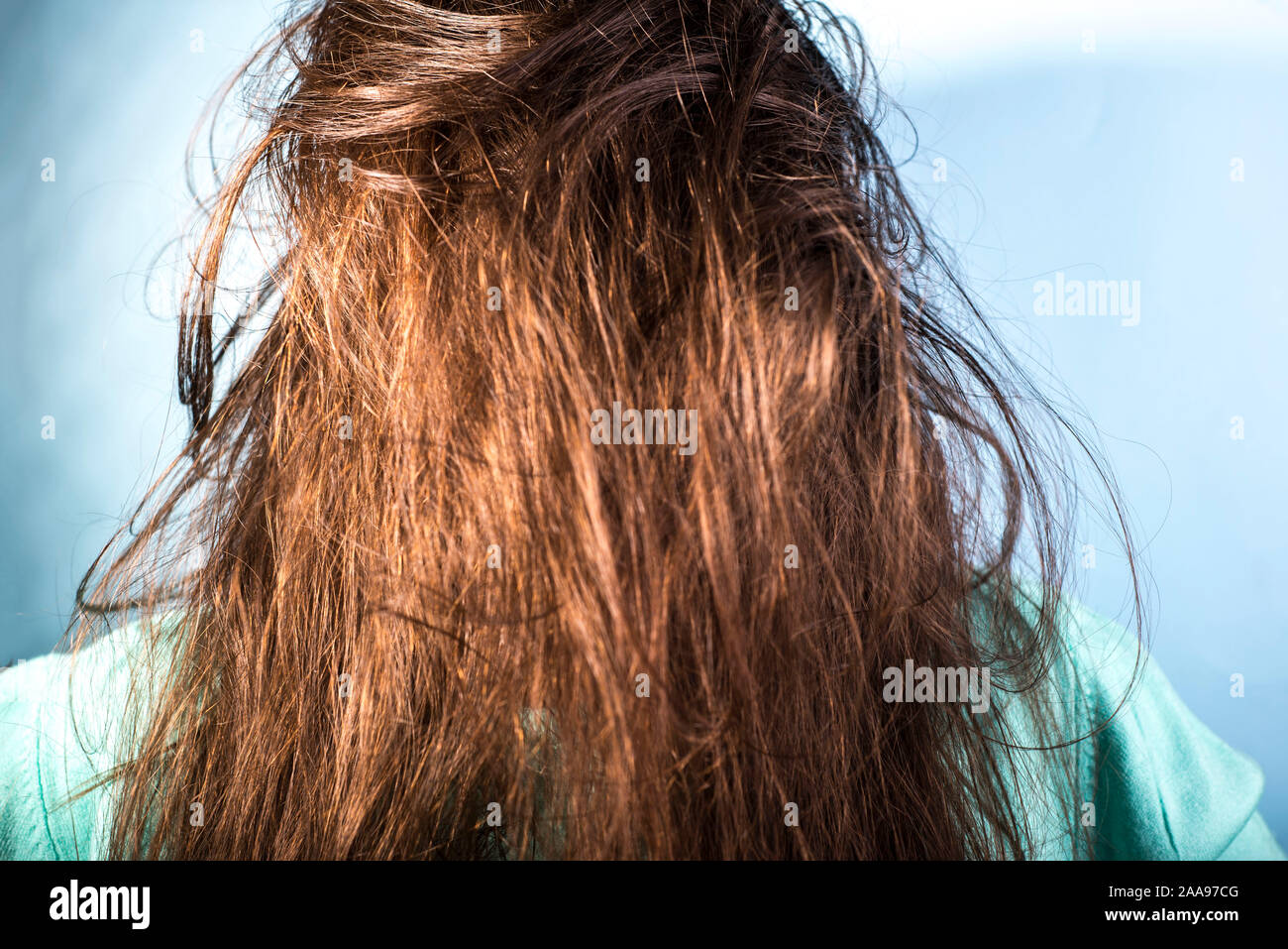 Ritratto di una ragazza con sporco, unto, disheveled capelli e cuoio  capelluto problematico. Su uno sfondo blu. Capelli dermatologiche, malattia  di forfora, seborroica Foto stock - Alamy