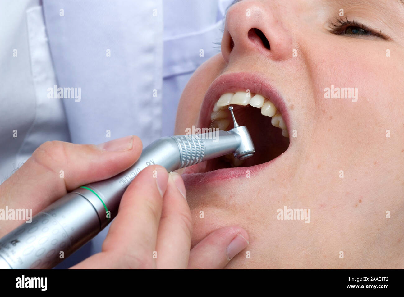 Zahnarztbehandlung (MR) Foto Stock