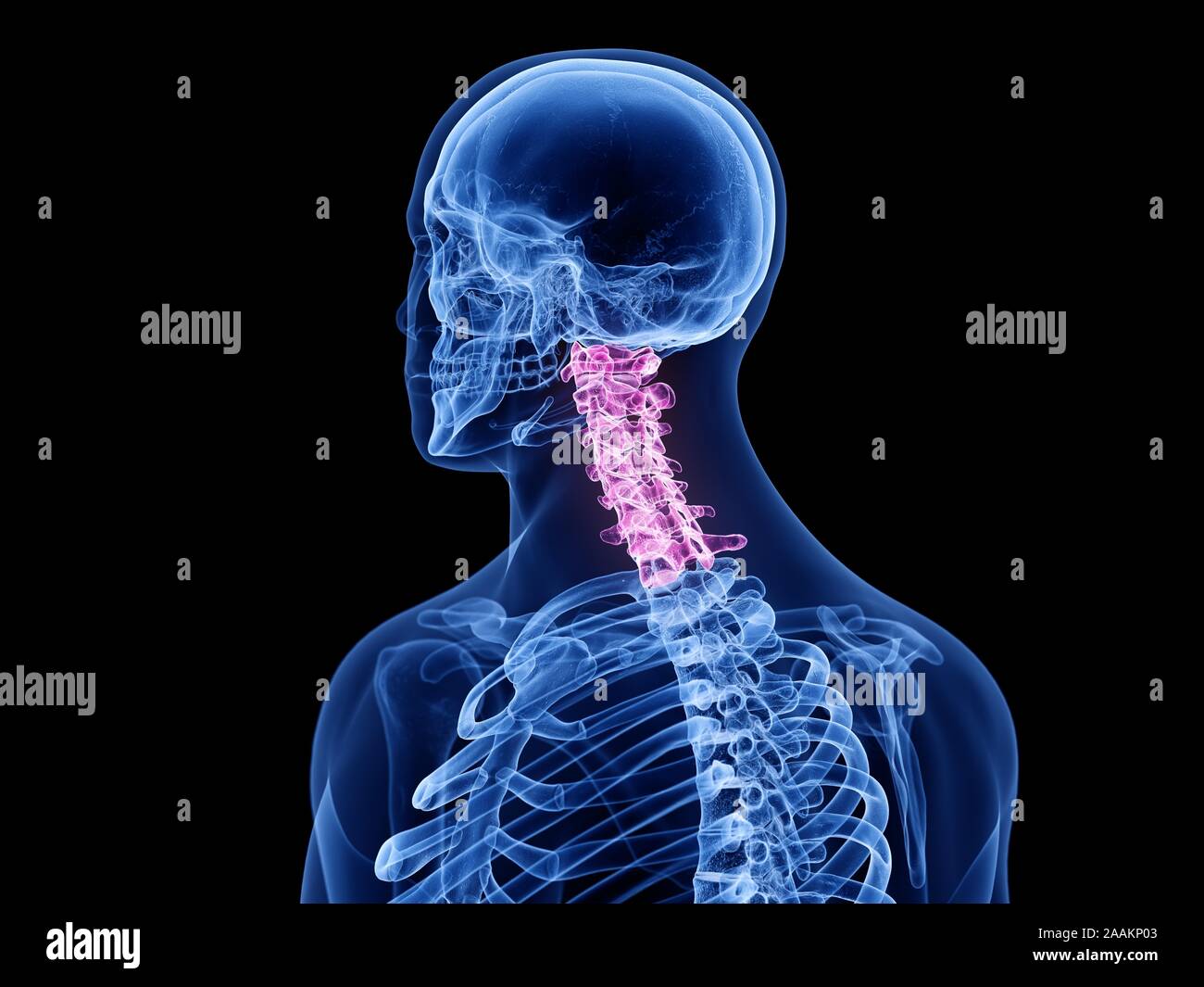 Colonna cervicale, illustrazione del computer. Foto Stock