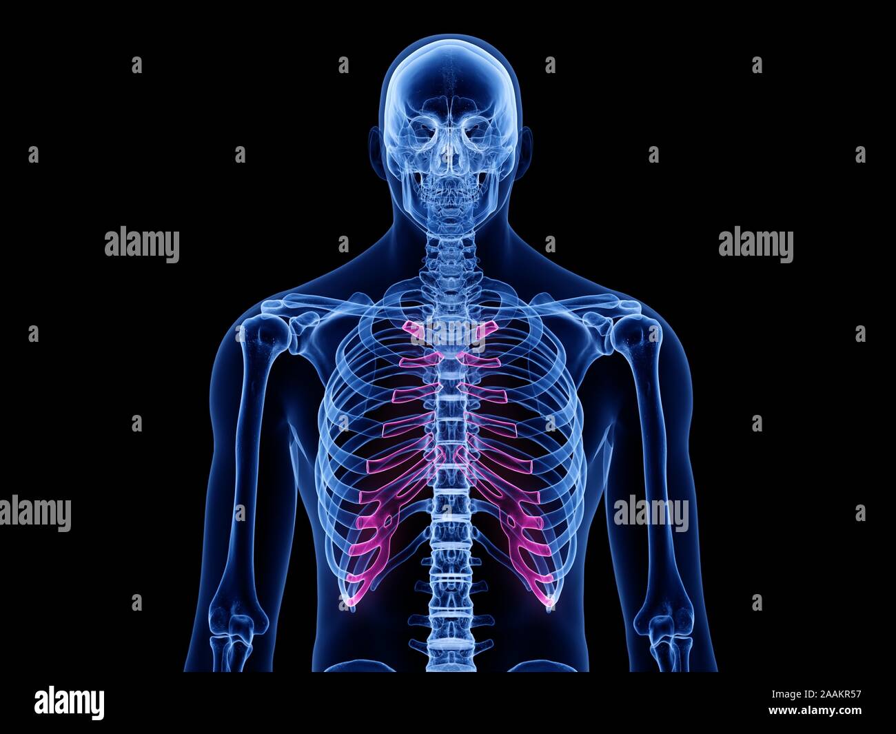 Cartilagine costale, illustrazione del computer. Foto Stock