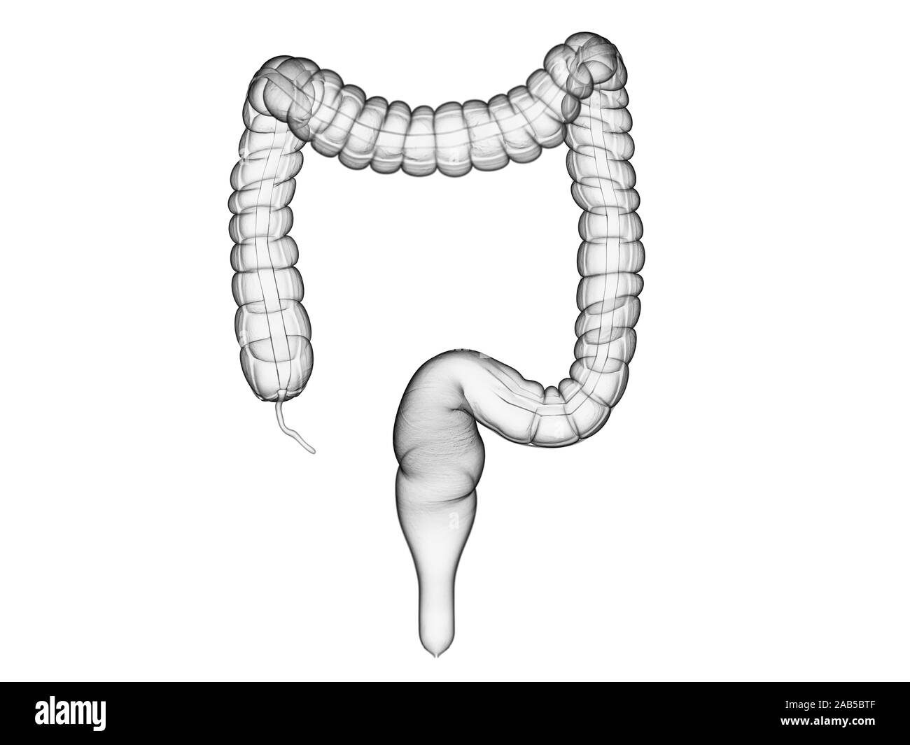 3D Rendering accurato dal punto di vista medico illustrazione del colon Foto Stock