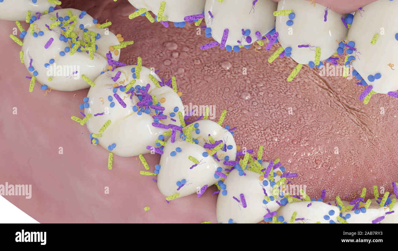 Rendering 3D illustrazione concettuale che mostra i batteri sui denti Foto Stock