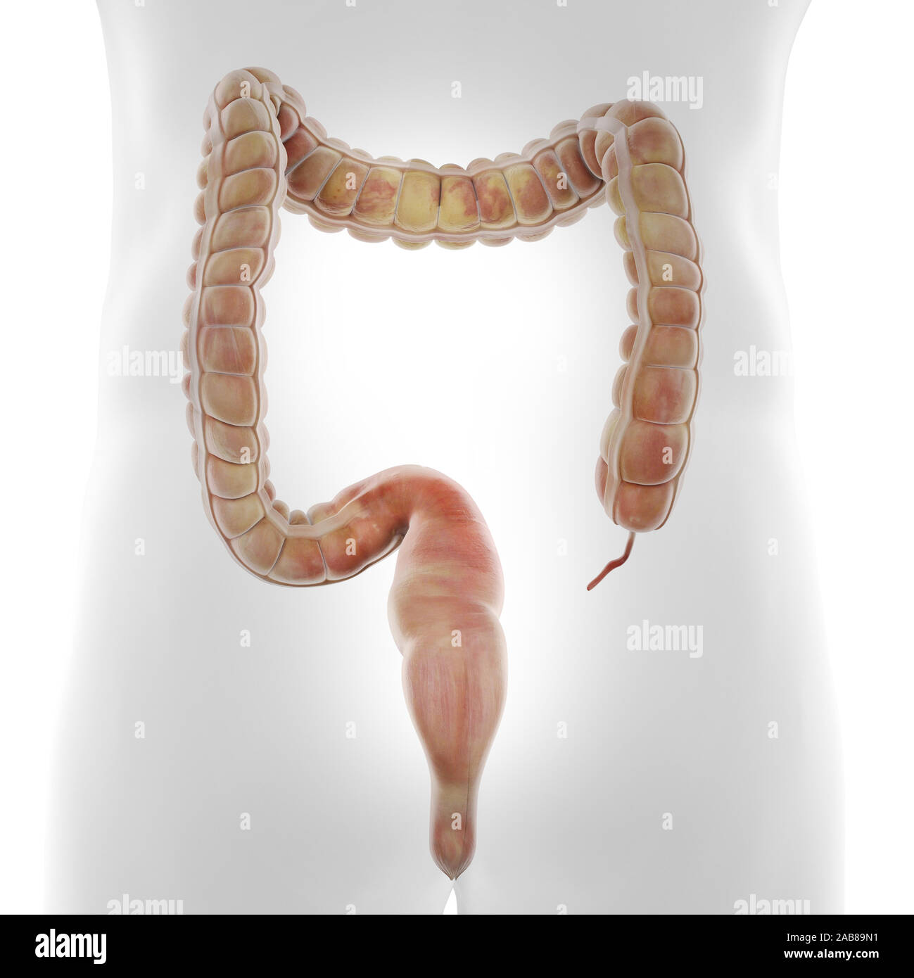 3D Rendering accurato dal punto di vista medico illustrazione del colon umano Foto Stock