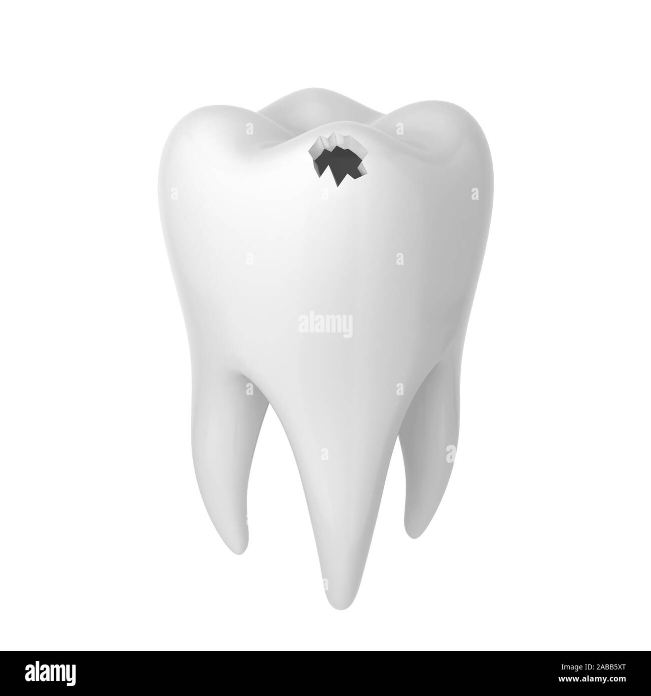 Radice di un dente Foto e Immagini Stock in Bianco e Nero - Alamy