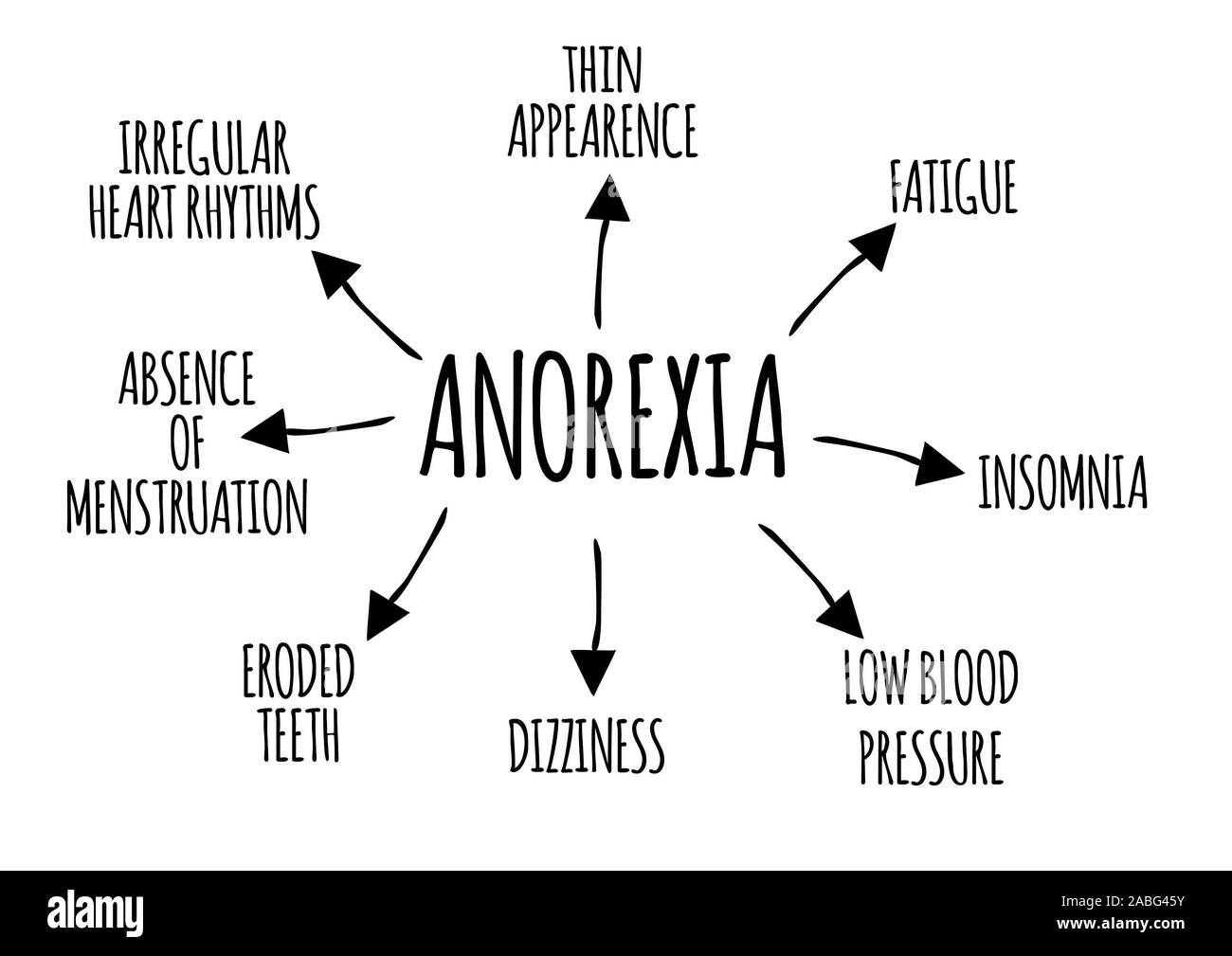 Schema di effetti collaterali di anoressia su sfondo bianco. Fisica e Mentale di effetti collaterali Foto Stock
