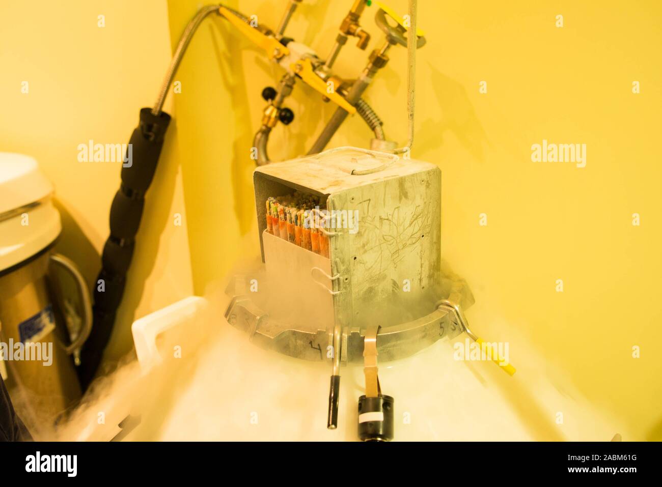 Cellule uovo può essere memorizzato nel laboratorio della IVF Spains, uno dei quattro cliniche di Riproduzione in Alicante, per un lungo periodo di tempo utilizzando kyrotechnics. [Traduzione automatizzata] Foto Stock