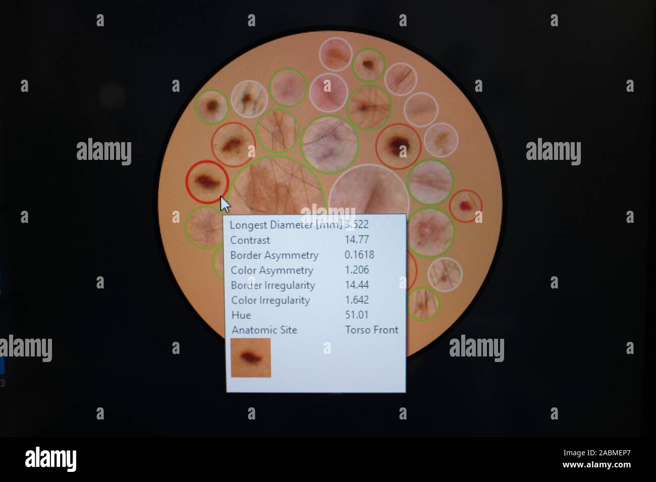 Presentazione della Germania prima del 3D full-body scanner nel dipartimento di canto, la plastica e la chirurgia estetica all'ospedale universitario di Monaco di Baviera in Pettenkoferstraße. [Traduzione automatizzata] Foto Stock