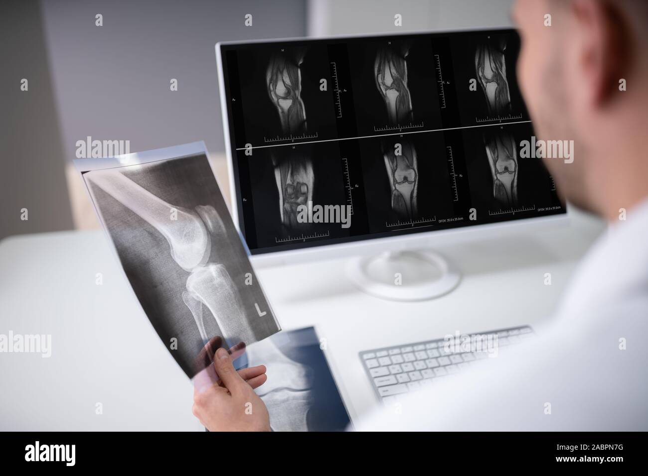 Maschio maturo esame medico ginocchio X-ray in clinica Foto Stock