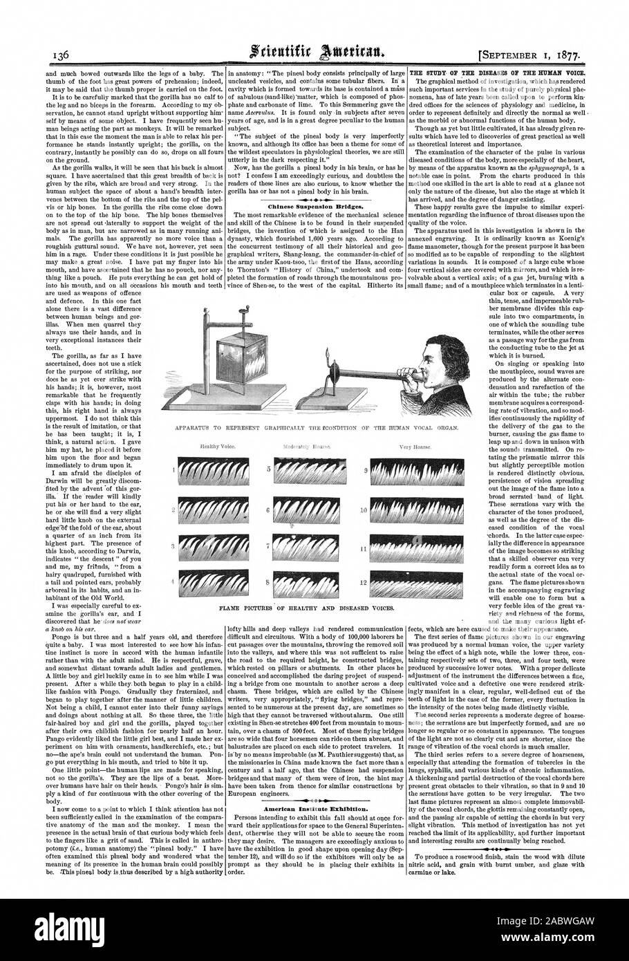 Cinese ponti di sospensione. American Institute mostra. Apparecchiatura T Foto di fiamma di sani e malati voci. Un, Scientific American, 1877-09-01 Foto Stock