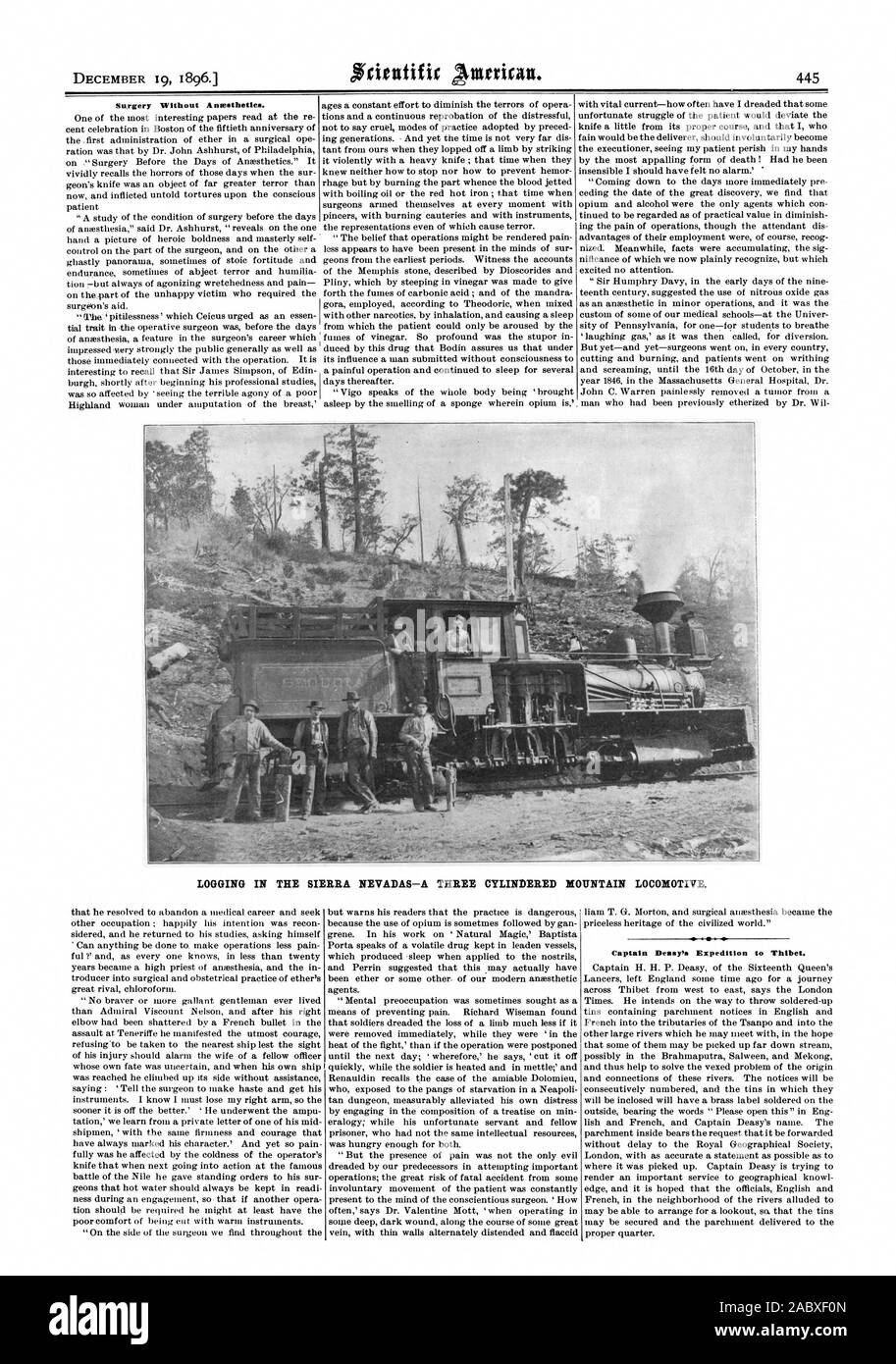 Chirurgia senza Antestheties. Il disboscamento IN SIERRA NEVADAS-A TRE CYLINDERED locomotiva di montagna. Capitano Deasy la spedizione Thibet., Scientific American, 1896-12-19 Foto Stock