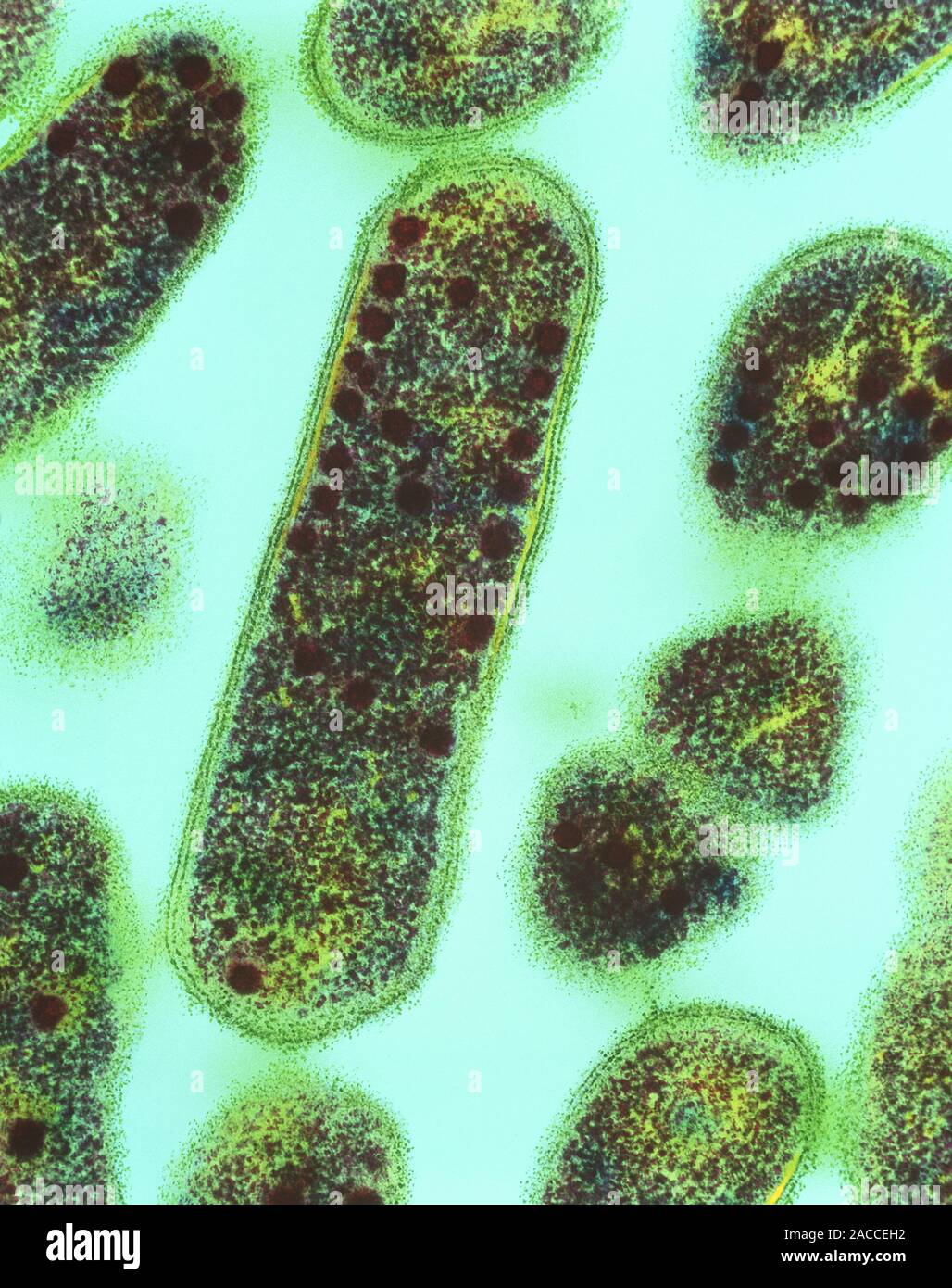 Gardnerella vaginalis batteri. Colorato micrografia elettronica a  trasmissione (TEM) di Gardnerella vaginalis batteri. Questo batterio si  trova nell'uomo Foto stock - Alamy