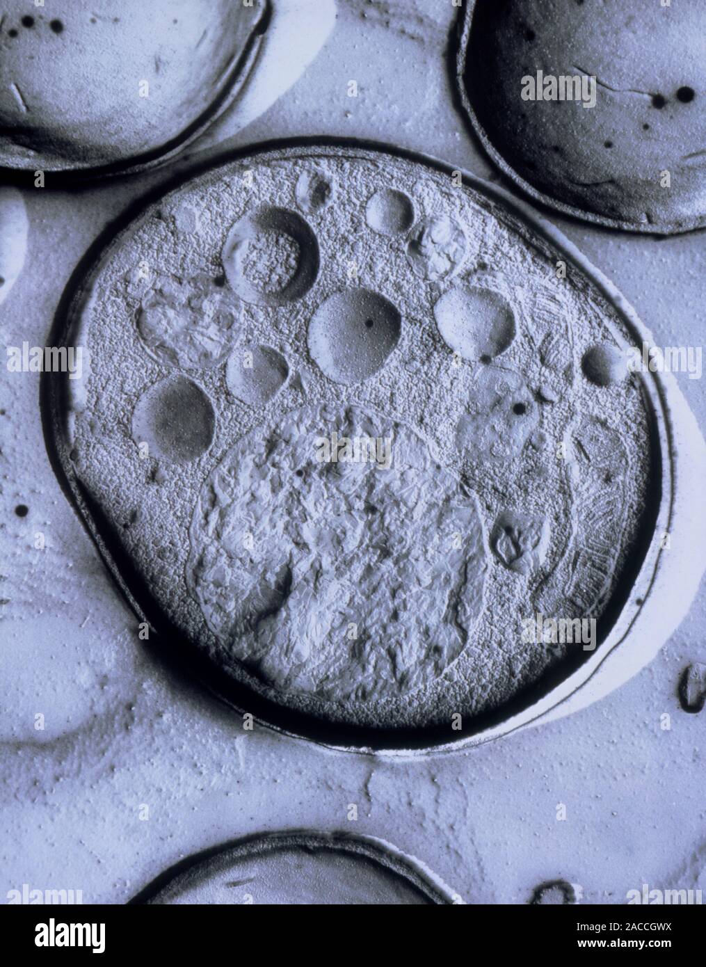 Micrografia elettronica a trasmissione di frattura per congelamento di una cellula di lievito, Rhodosporidium toruloides. La grande struttura circolare in corrispondenza del fondo della centrale ce Foto Stock