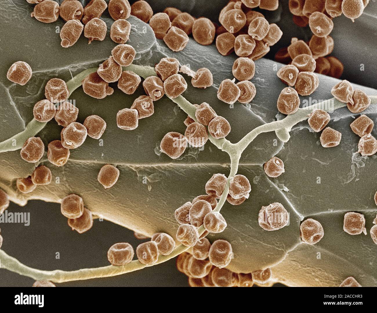 Spore fungine. Color scanning electron microfotografia (SEM) delle spore di  un fungo non identificato (rosso) su un gatto pelo Foto stock - Alamy