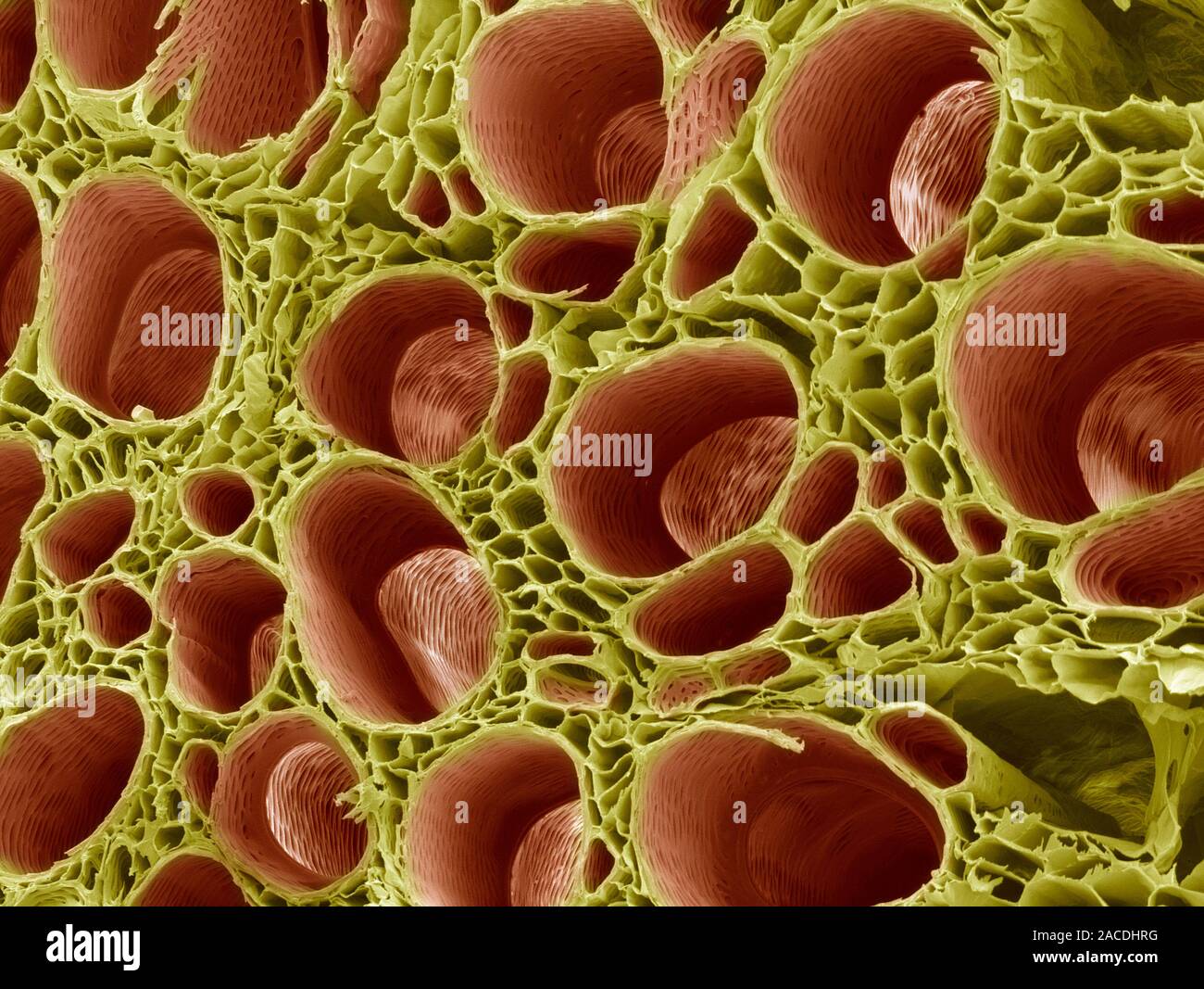 Xilema tessuto. Color scanning electron microfotografia (SEM) di una sezione attraverso lo xilema tessuto da un dicotiledoni rootlet. Xilema navi (marrone) traspor Foto Stock