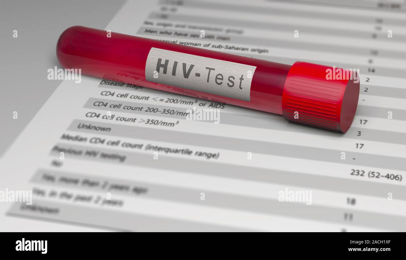 Il test del virus HIV, tubo di sangue. Analisi per scoprire se il computer è stato infettato con il virus. L AIDS. Il virus di immunodeficienza umana, 3D render Foto Stock