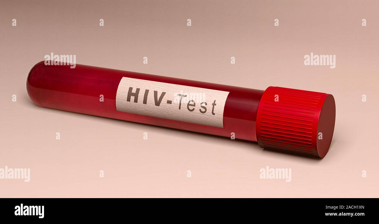 Il test del virus HIV, tubo di sangue. Analisi per scoprire se il computer è stato infettato con il virus. L AIDS. Il virus di immunodeficienza umana, 3D render Foto Stock