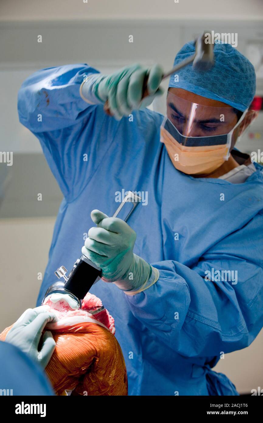 La chirurgia di sostituzione del ginocchio. Chirurgo ortopedico utilizzando  un martello durante una sostituzione totale del