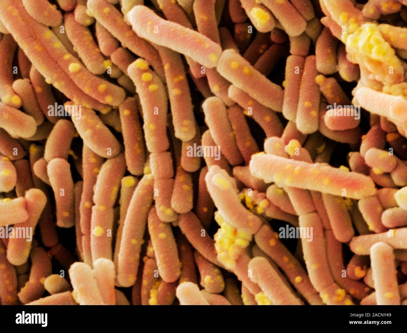 Lactobacillus casei batteri. Scanning electron microfotografia (SEM) del batterio  Lactobacillus casei. L. casei è un batterio che si trova in un ronzio Foto  stock - Alamy