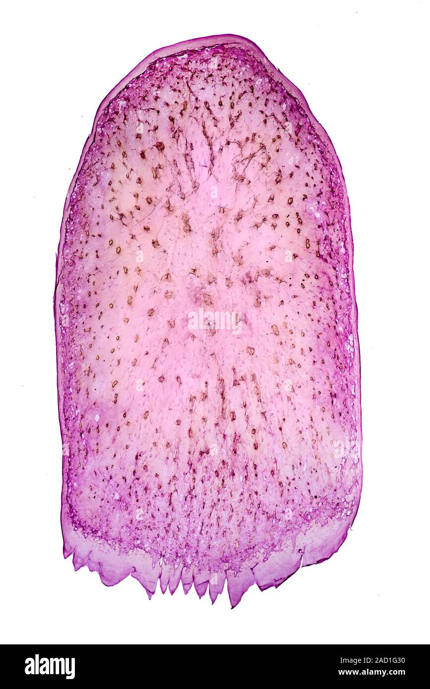 Pesci marini scala, fotomicrografia in campo chiaro. Scala Ctenoid, Tunna, Thunna sp. Foto Stock