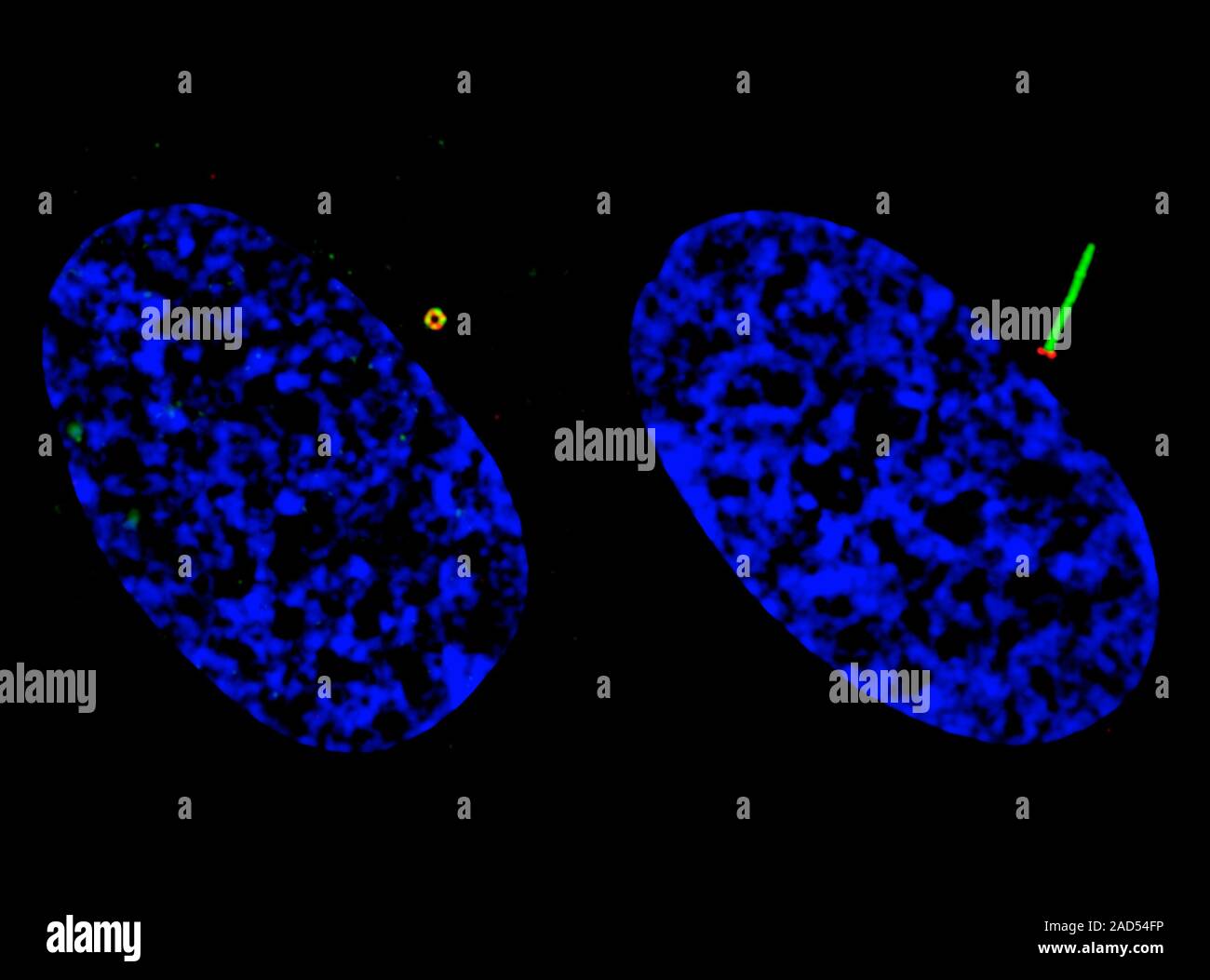 Ciglia a difetti di base della ricerca contro il cancro. Illuminazione strutturata microscopy (SIM) imaging di due uomo epitelio del pigmento retinico (RPE) cellule, mostrando il cil Foto Stock