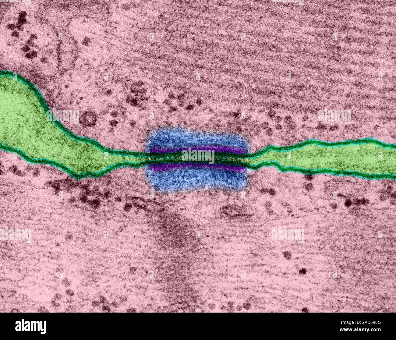 Desmosome (noto anche come la macula adherens) fra il cuore delle cellule muscolari, colorato di microscopio elettronico a trasmissione (TEM). I desmosomi sono intercellulare di ju Foto Stock