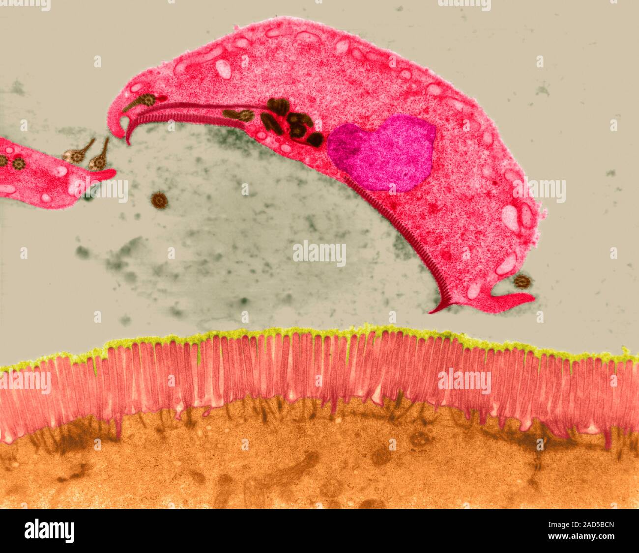 Infezione da protozoi (giardiasi) umani nel lume intestinale (Giardia sp.),  colorata micrografia elettronica a trasmissione (TEM). Giardia lamblia, un  uomo pa Foto stock - Alamy