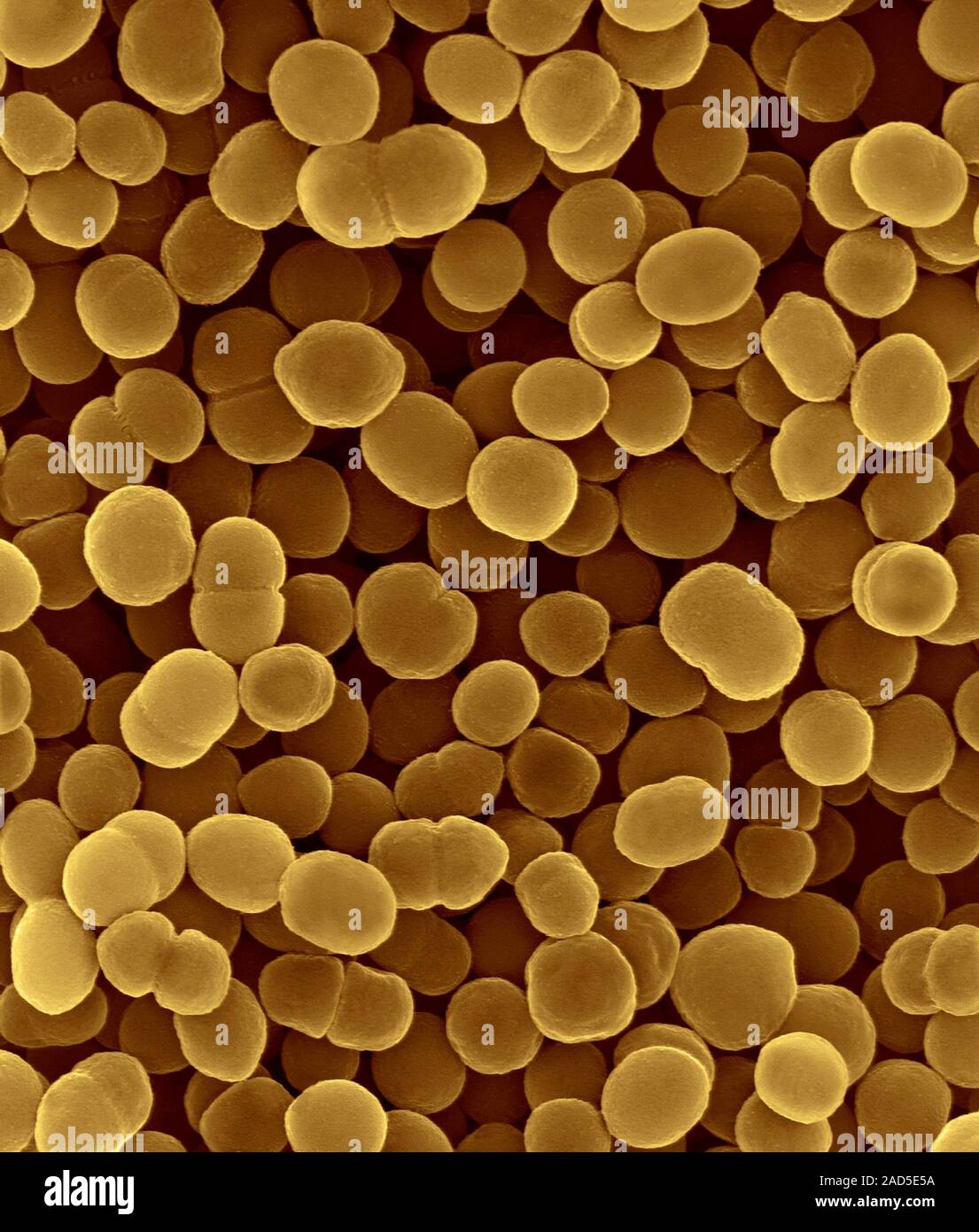 Color scanning electron microfotografia (SEM) di Moraxella catarrhalis, gram-negativi, aerobica, ossidasi-positivo, diplococcus batterio. Moraxella catar Foto Stock