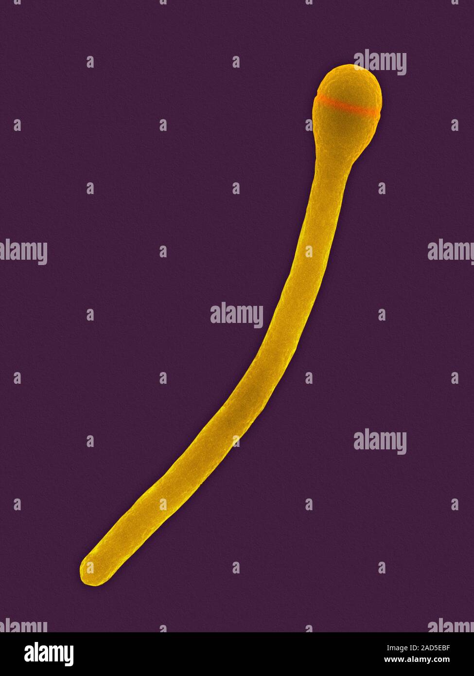 Color scanning electron microfotografia (SEM) di Clostridium phytofermentans, Gram-positivi, anaerobico, astiformi procariota (batterio). C. phytoferme Foto Stock