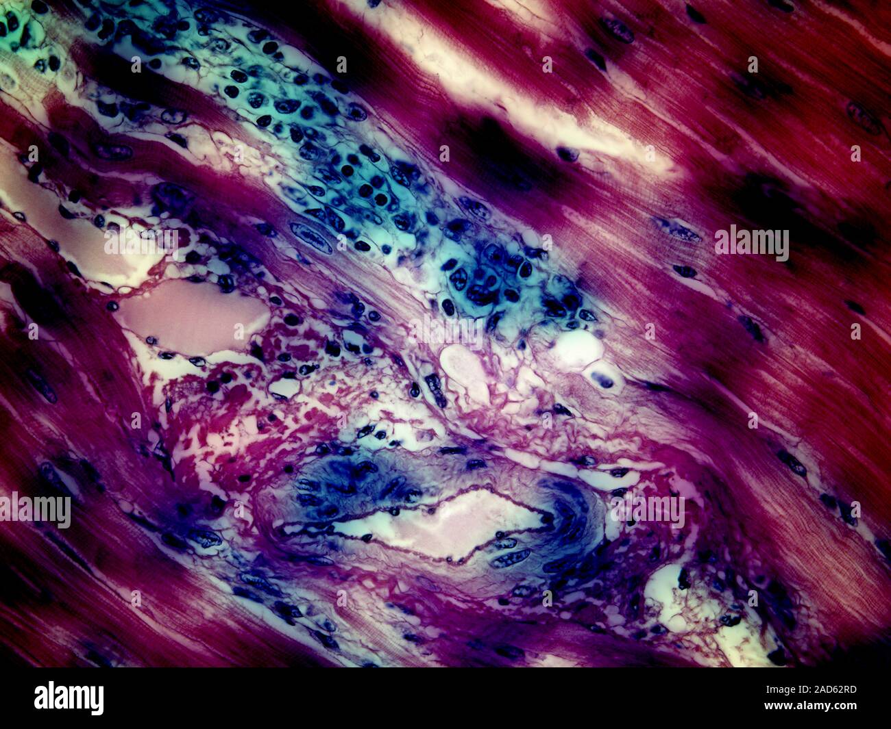 Il muscolo cardiaco e di altri tessuti. Migliorate digitalmente micrografia luce del cuore (rosa) e altri tessuti (blu, compresi vasi sanguigni) colorato con Foto Stock