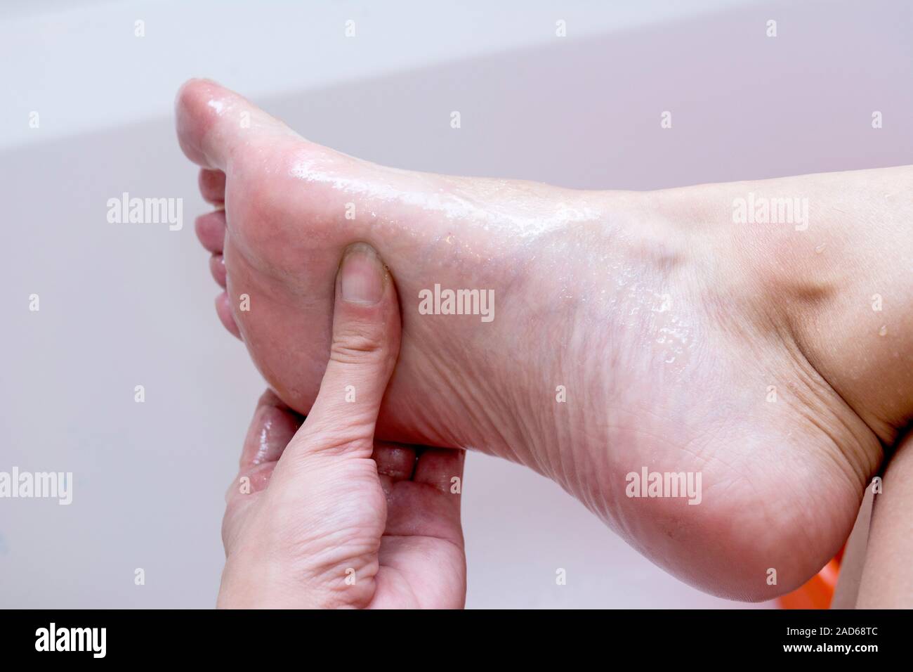 Antibatterico scrub al miele per la rimozione del tessuto morto da la pelle delle gambe Foto Stock