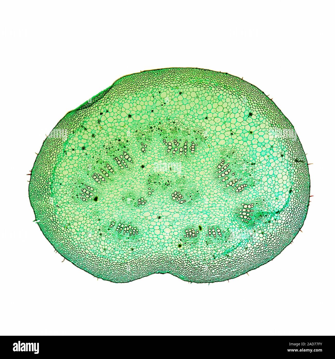 Micrografia Mulberry image Foto Stock