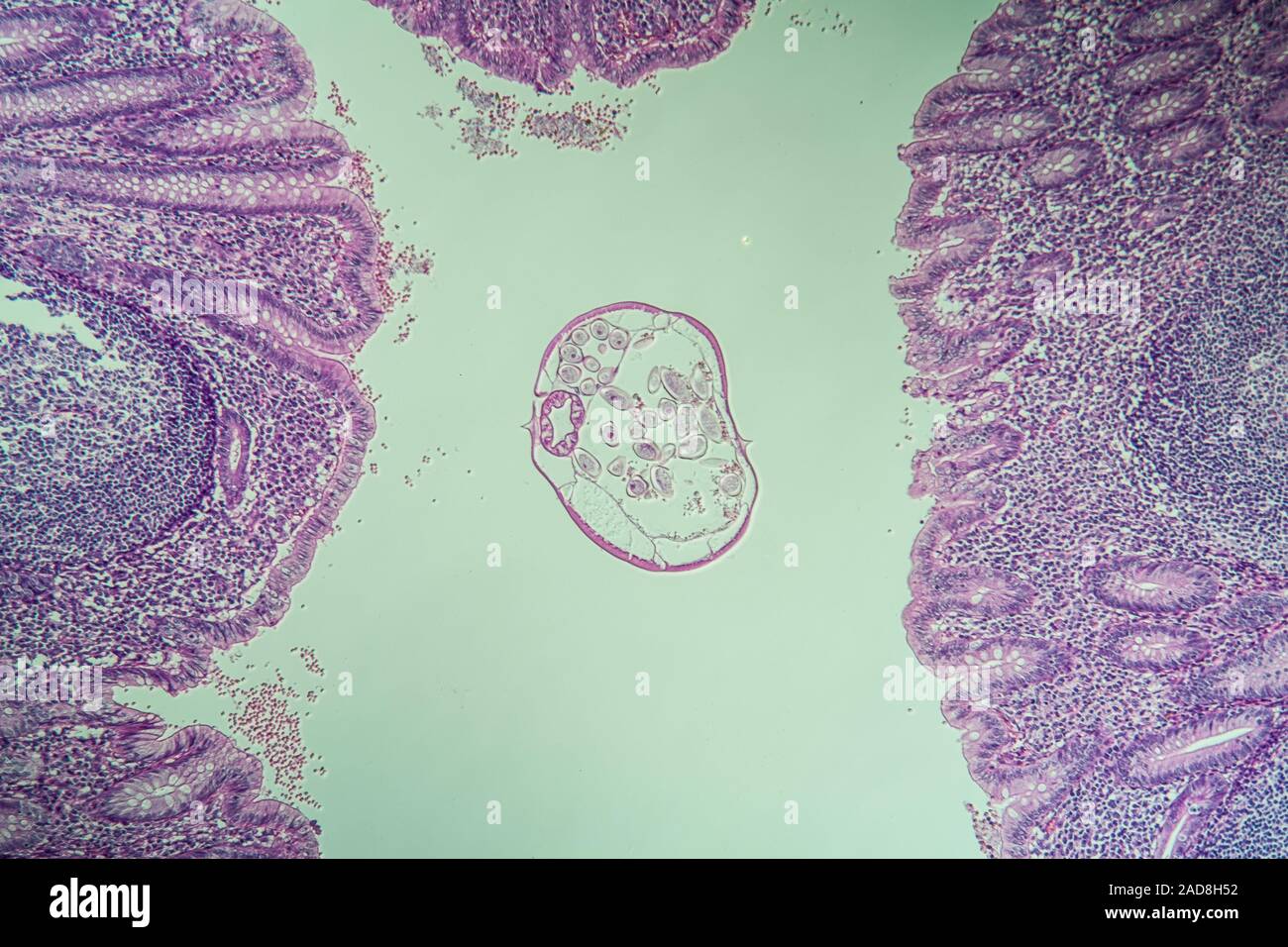Il cieco con parassiti Oxiuris, pinworm nell'intestino, 100x Foto Stock