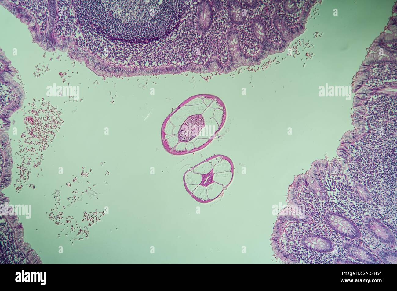 Il cieco con parassiti Oxiuris, pinworm nell'intestino, 100x Foto Stock