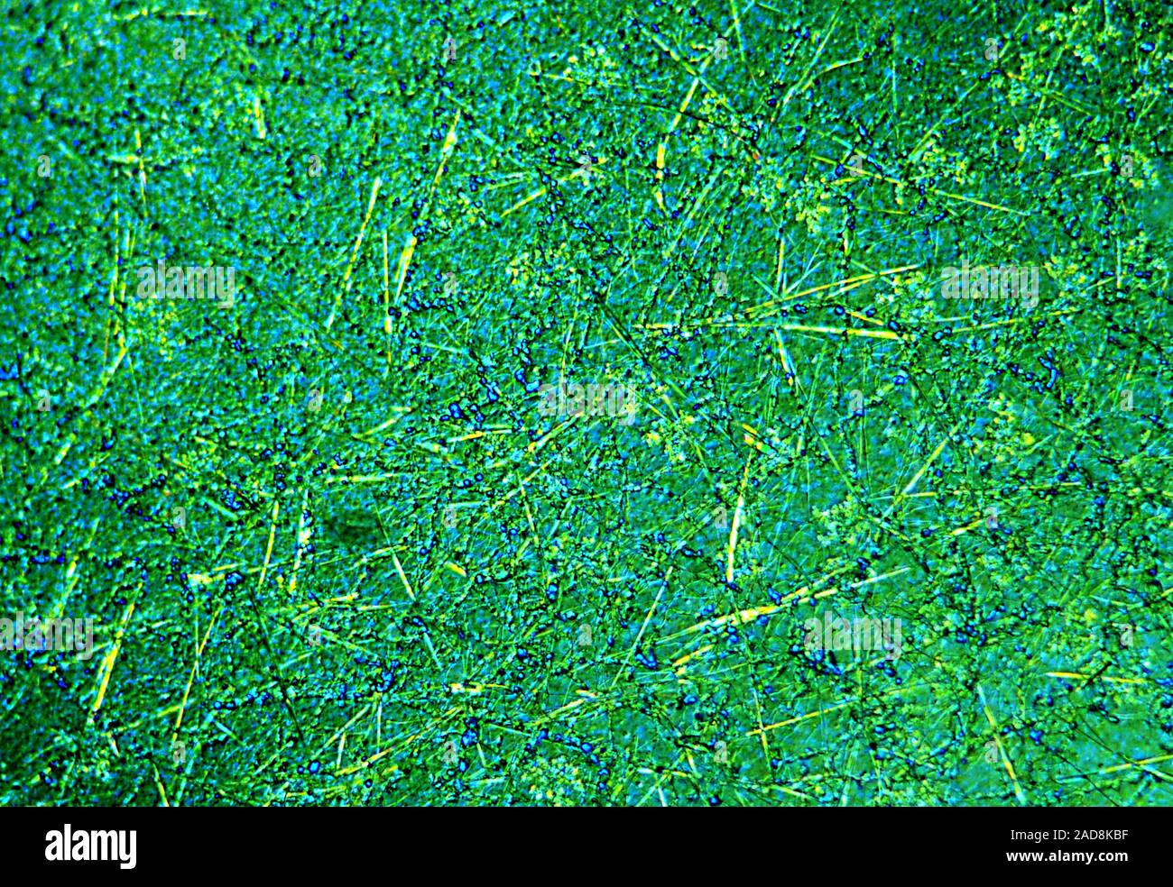 Funghi e batteri di distruggere la pellicola in emulsione sotto il microscopio 100x Foto Stock