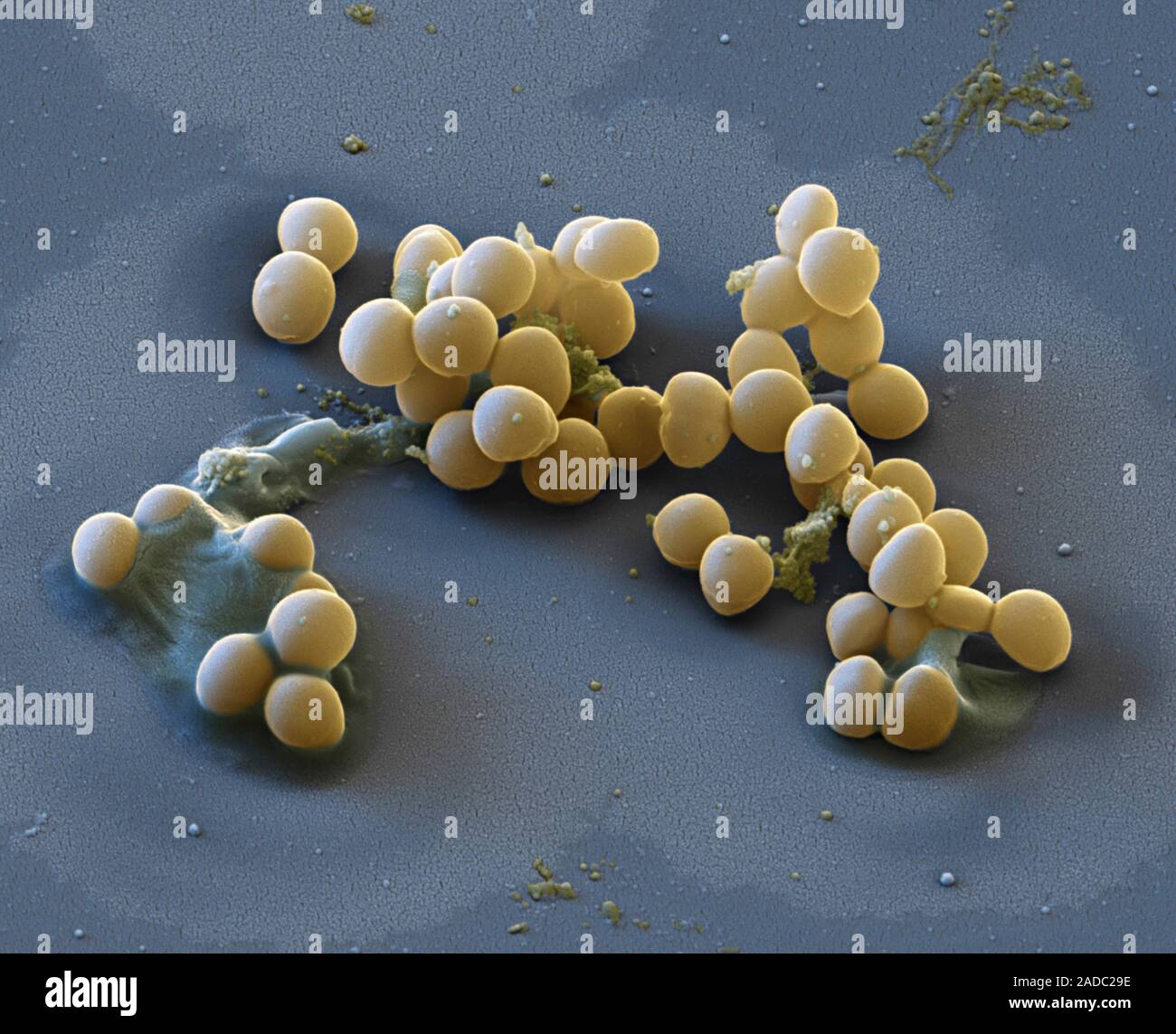 Staphylococcus lugdunensis i batteri, colorata di microfotografia electron scansione (SEM). Questo batterio Gram positivo può verificarsi innocuamente sulla pelle umana, ma Foto Stock