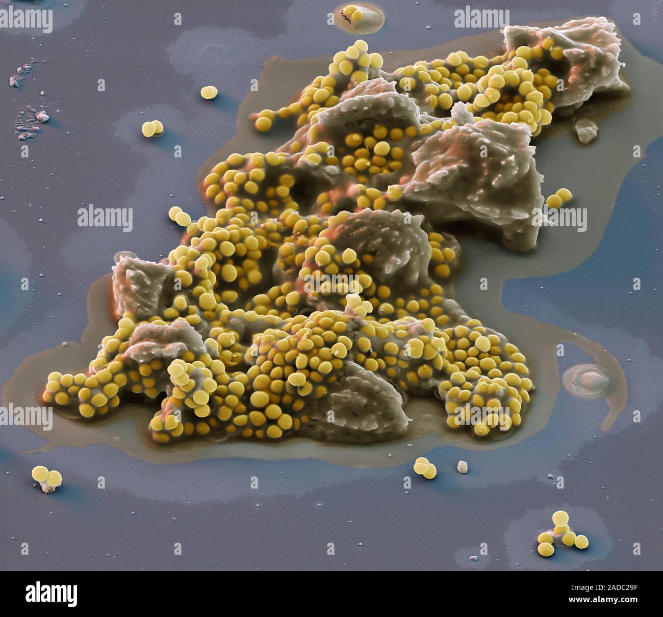 Staphylococcus Lugdunensis I Batteri Colorata Di Microfotografia