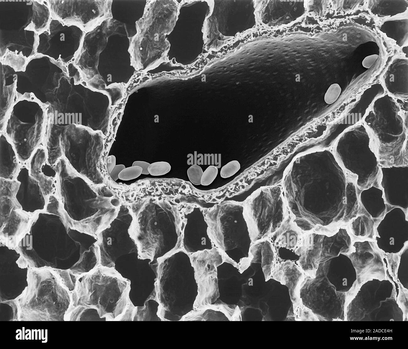 Micrografia al microscopio elettronico a scansione (SEM) di ...