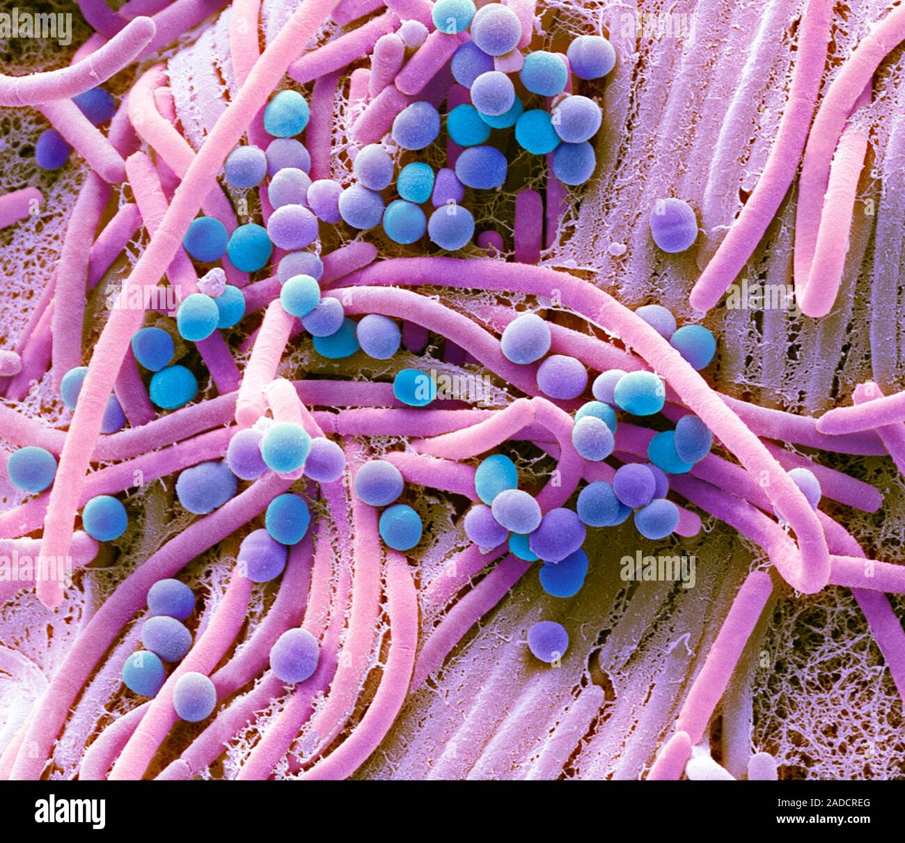 Batteri fecali. Micrografia al microscopio elettronico a scansione (SEM) di  batteri coltivati da un campione di feci umane. Almeno il 50 per cento  delle feci umane è realizzato u Foto stock - Alamy