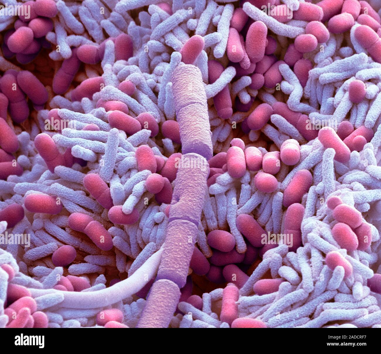 Lavastoviglie batteri, scanning electron microfotografia (SEM) dei batteri  trovati in una lavastoviglie domestica. Detergenti per lavastoviglie sono  progettati per la pulizia, b Foto stock - Alamy