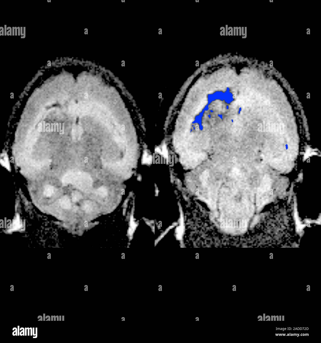 Nanochains mirati nel cancro al cervello. Imaging a risonanza
