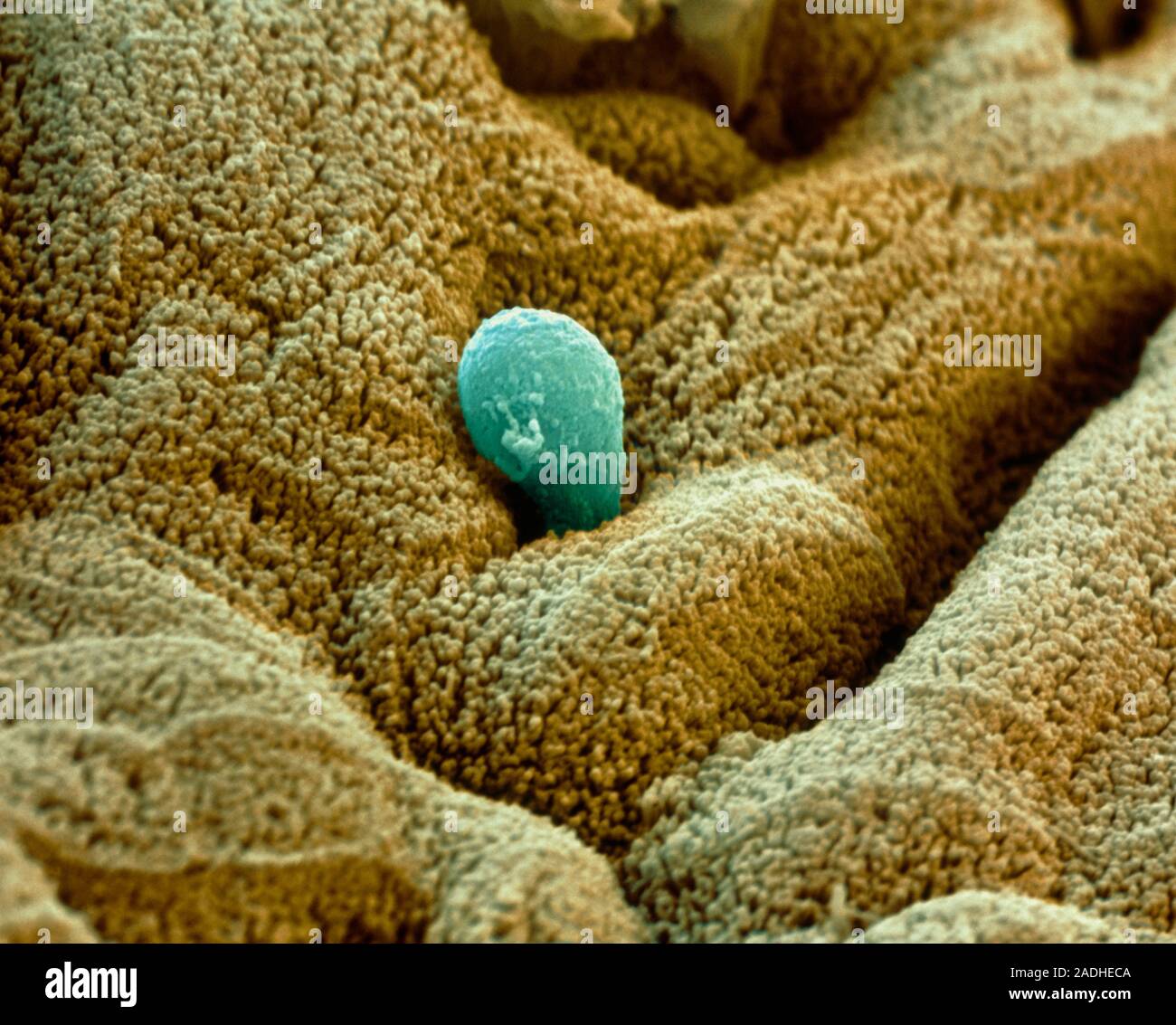 Entamoeba parassita. Color scanning electron microfotografia (SEM) di un Entamoeba histolytica ameba (blu) che invadono il rivestimento dell'intestino crasso ( Foto Stock