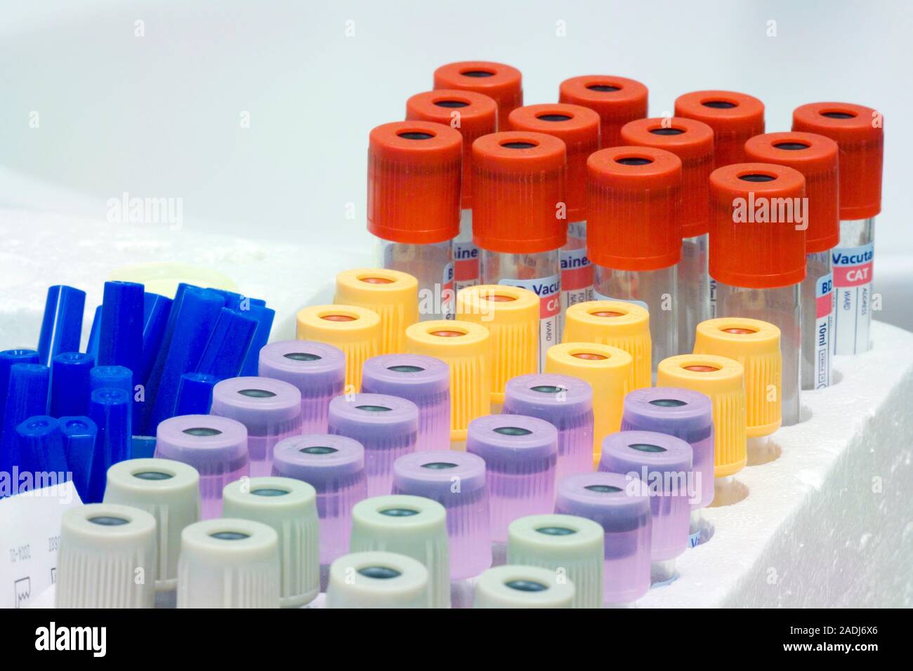 I campioni di sangue in provette vacutainer in attesa di essere analizzati.  Il colore del tappo della provetta vacutainer indica il tipo di test da  eseguire, o Foto stock - Alamy