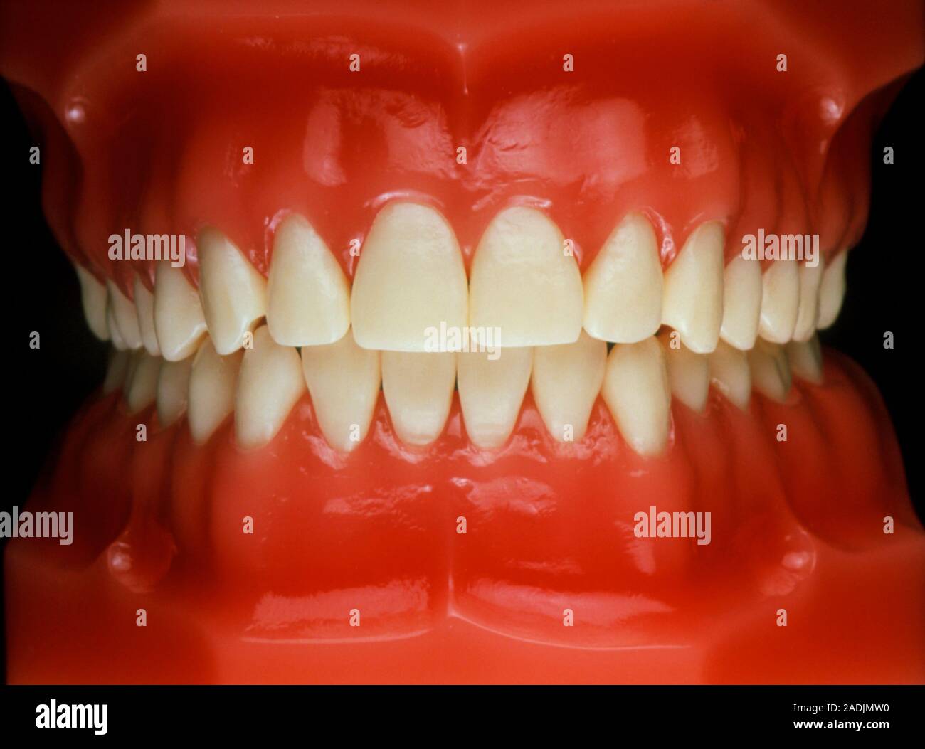 Denti finti. Modello dentale di un coppia di chiusa denti finti visto dalla  parte anteriore Foto stock - Alamy