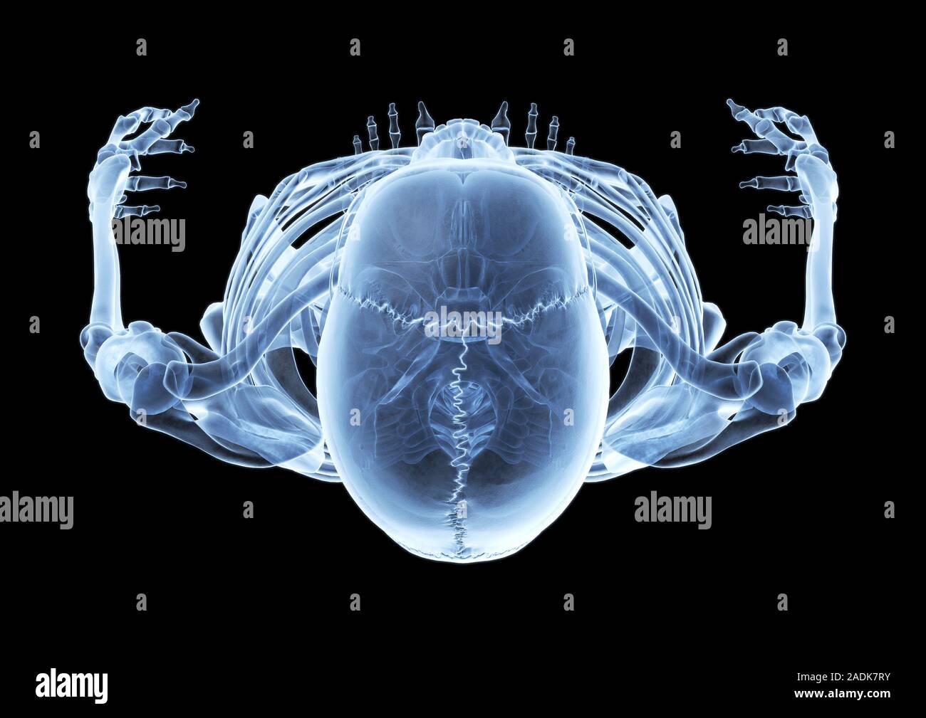 Scheletro. Computer X-ray illustrazione di uno scheletro umano visto dall' alto Foto stock - Alamy