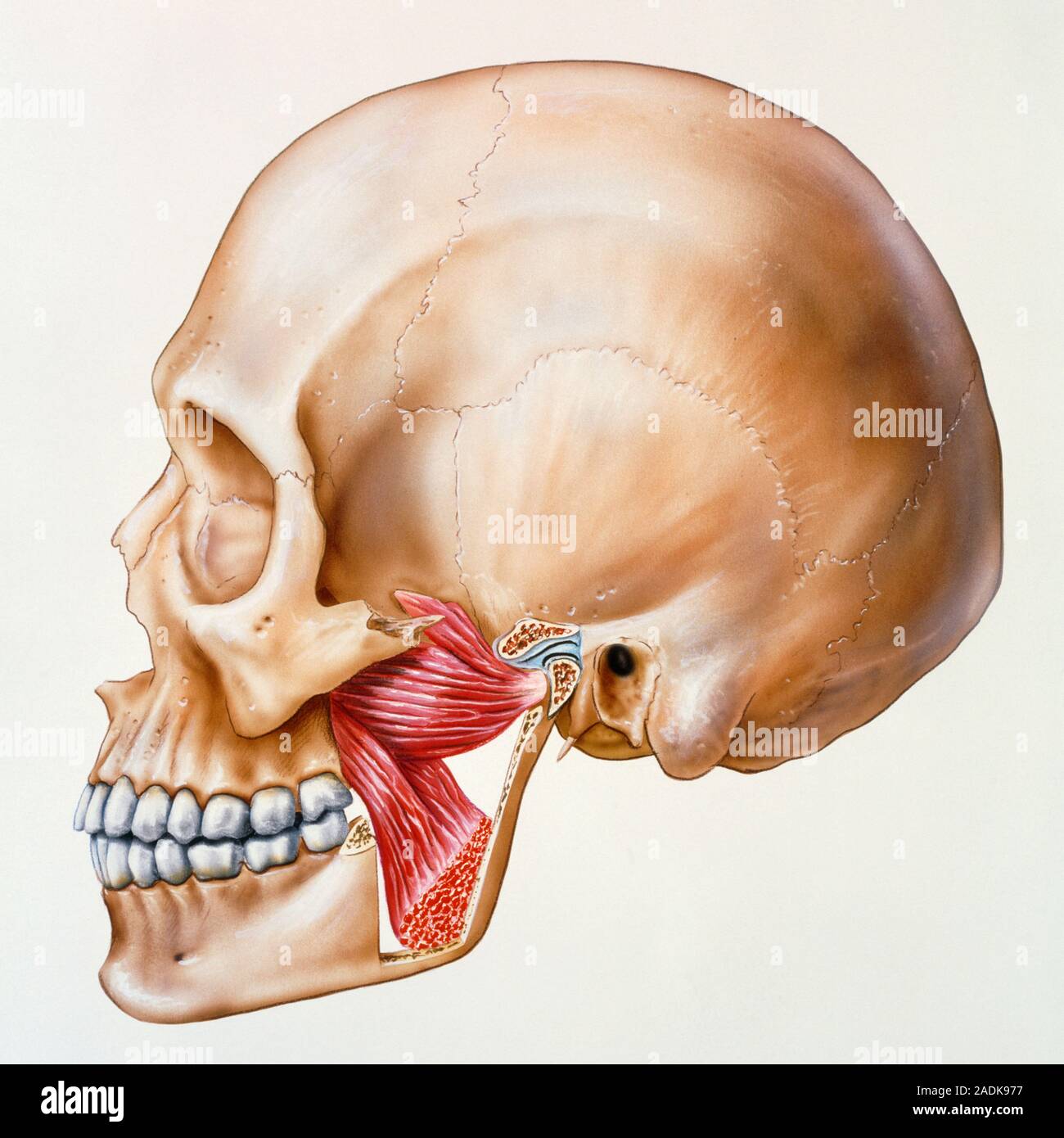Muscoli masticatori. Illustrazione del cranio umano con parte della ganascia asportate per mostrare i muscoli della masticazione (masticazione). La faccia del cranio ( Foto Stock