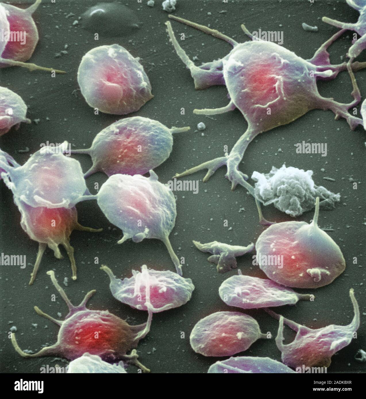 Le piastrine del sangue. Color scanning electron micro- grafico (SEM) di attivazione di piastrine di sangue. Cellule di piastrine (trombociti) sono formate nell'osso marr Foto Stock