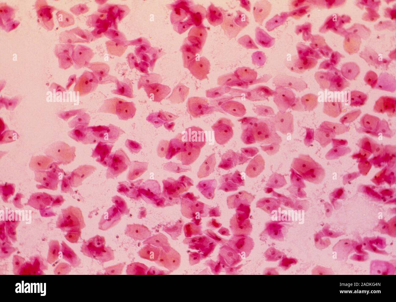 Guancia di cellule. Micrografia luce di cellule epiteliali squamose dalla  bocca umana. Questi piatti, scala-come le cellule hanno nuclei ovale (rosso  scuro) e granulare Foto stock - Alamy