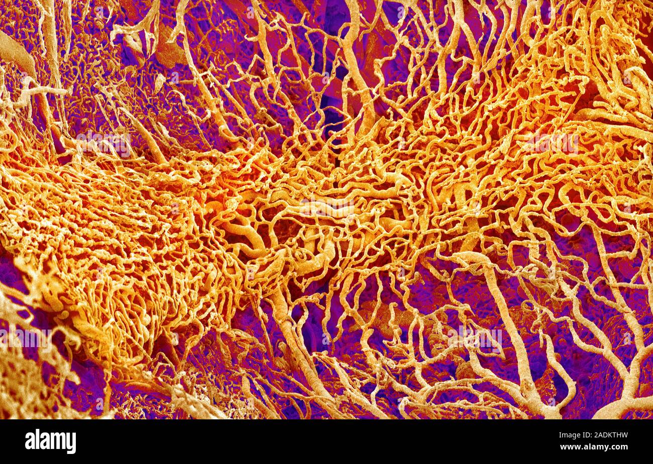 Il tessuto connettivo dei vasi sanguigni. Color scanning electron  microfotografia (SEM) di una resina colata di vasi sanguigni in un tipo di  tessuto connettivo chiamato th Foto stock - Alamy